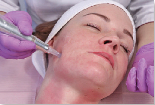 Step 3 &mdash; Meso Cocktail