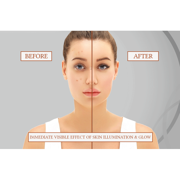MESO SKIN PERFECTOR (LIGHT 5 x 6 ml)