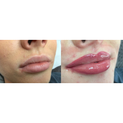 Masterclass 3D lips