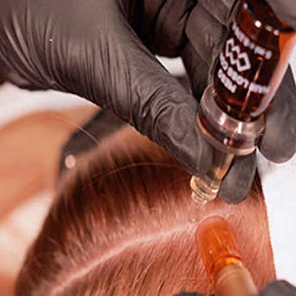 CPD Hair Growth & Loss Prevention Course (Online & Practical)
