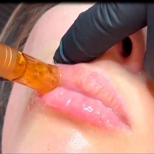 MESO LIPVOLUME Master Course (ONLINE THEORY, PRACTICAL TRAINING AT THE COURSE CENTER)
