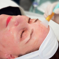 CPD-Certified Clinical Peel Course (ONLINE THEORY, PRACTICAL TRAINING AT COURSE CENTER)