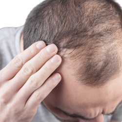 MESO HAIR GROWTH CONCEPT+ (Product package)