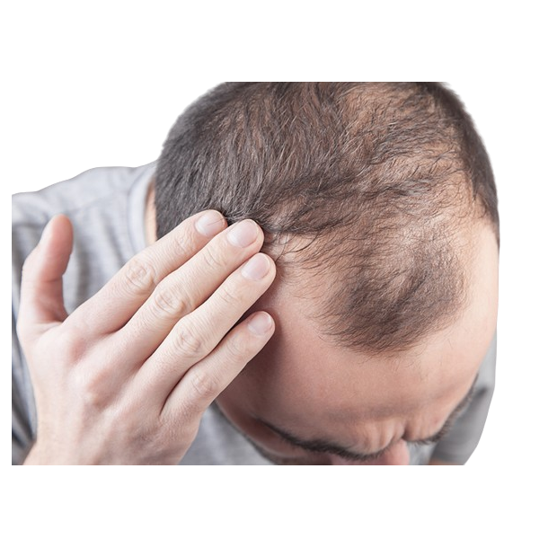 MESO HAIR GROWTH CONCEPT+ (Product package)
