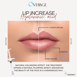 OVERAGE BLUE  2.0 ml (MESO)