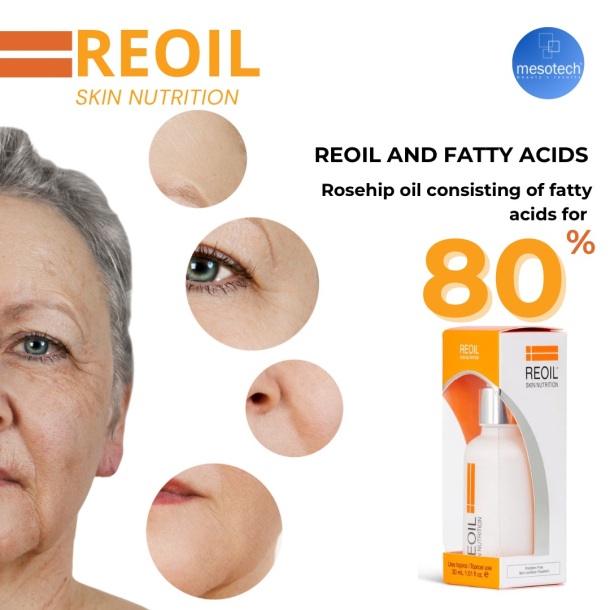 REOIL (30mL)