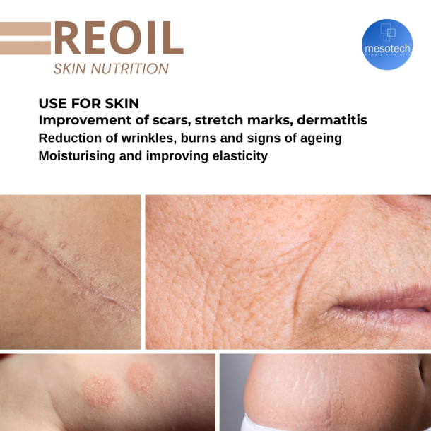 REOIL (30mL)