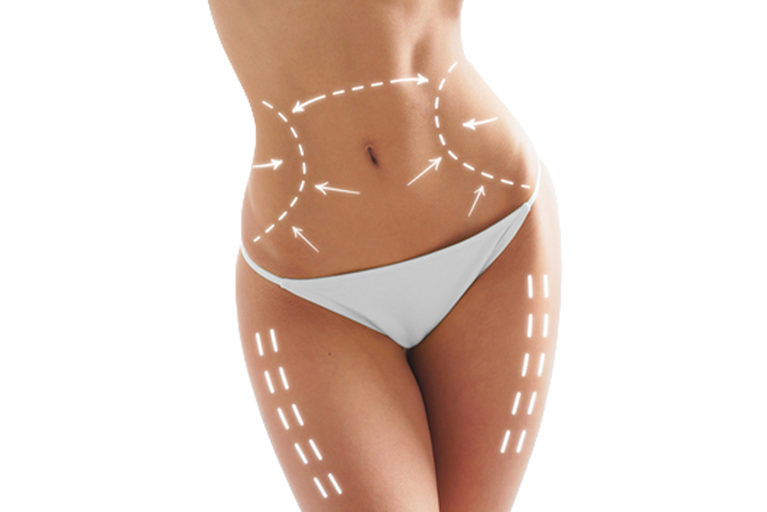 Meso cocktails for body, stomach, legs, neck, and d&Atilde;&copy;collet&Atilde;&copy;