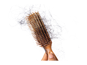 Professional Hair Loss Products