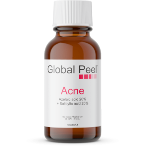 GLOBAL PEEL ACNE